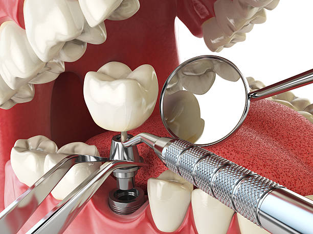 Best Emergency Broken Tooth Repair in Fruit Hill, OH