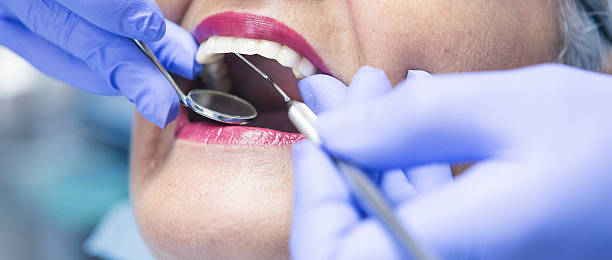 Best Emergency Wisdom Teeth Removal in Fruit Hill, OH
